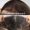 Ombre Blonde Lace Front Bob Wig, Short Straight Glueless Synthetic Wig for Women, Pre-Plucked Hairline with Brown Roots, 13x6 HD Lace Bob Wig for Daily Wear 10IN (Dark Brown) view 3