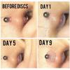 DIMITU 10 Pcs Anti-hyperplasia Piercing Discs Silicone Fixing Lip Earrings Piercing Accessories Disc Pads view 3