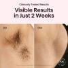 Wavytalk IPL Laser Hair Removal,Bare It with Precision Roller for Full Body view 3