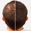 Hair Building Fibers J 100% Rayon Keratin. Size: 1 Pound (454 Grams ) Bulk Refill Pack 60-80% SAVINGS. From Competitors like Super Million Dollar Hair. (Light Brown, 454 Grams) view 1