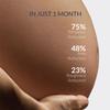 AreoVeda Stretch Marks Removal Cream (50g) | Targets Stubborn Old & New Stretch Marks | Powered With Striover & CryoCoffee | Non-Sticky, Fast Absorbing | Pregnancy & Breastfeeding Safe view 2