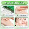 XINGXYUEL 30 Pack 99% Pure Aloe Vera Gel Travel Size, After Sun Relief Skin view 4
