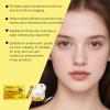 Viareline Snail Essence Anti-Wrinkle Eye Mask, 40 Pieces view 4
