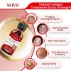 SOVS Toenail Treatment,Gentle Formula, Effectively Improves Nails for a More Beautiful Appearance1pcs view 2