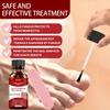 SOVS Toenail Treatment,Gentle Formula, Effectively Improves Nails for a More Beautiful Appearance1pcs view 4