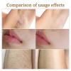 Coconut Oil Facial Hair Removal Cream for Women, Plant Extract Coconut Oil Body Hair Removal Cream, Painless Hair Removal, Suitable for Sensitive Skin view 4