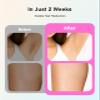 LYSMOSKI Laser Hair Removal for Women and Men, At-Home IPL Hair Removal Device with 5.2 cm Treatment Window, Nearly Painless, Visible Results in 2 Weeks, Full Body Treatment in 8 Minutes,Pink view 3