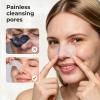 TKTK Blackhead Nose Patches, Gentle 3-Step Melting Blackhead, 8 Pcs view 2
