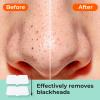 TKTK Blackhead Nose Patches, Gentle 3-Step Melting Blackhead, 8 Pcs view 3
