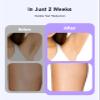LYSMOSKI Laser Hair Removal for Women and Men, At-Home IPL Hair Removal Device with 5.2 cm Treatment Window, Nearly Painless, Visible Results in 2 Weeks, Full Body Treatment in 8 Minutes,Purple view 3