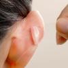10pcs Ear Stickers Invisible Corrector Patches Makeup V-face Stickers Easy Use Position Corrector Patches view 3