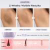 Cosytime FDA-Cleared IPL Laser Hair Removal for Women & Men, Painless Sapphire Ice Cooling Device, 24J Pro SHR Mode & Auto Glide view 3
