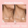 gawysbm Magic Collagen Fullerene Neck Cream - Firming & Lifting Neck Moisturizer with Collagen Peptides, Anti-Aging Magic Collagen Cream with 5-Roller Massager for Wrinkles, Fine Lines (3) view 4