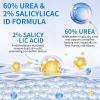 QKCXHB At Home Urea Foot Cream Stick 60% Maximum Strength Callus Remover Heel Balm for Dry Cracked Feet Treatment view 4