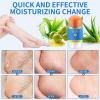 QKCXHB Elderly Foot Care Urea Cream Stick 60% with Shea Butter Callus Remover for Thick Dead Skin Removal Softening Treatment view 2