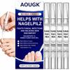 Toenail Fungus Pen with 25% Undecylenic Acid Nail Treatment, 4 Pack view 1