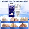 Toenail Fungus Pen with 25% Undecylenic Acid Nail Treatment, 4 Pack view 3