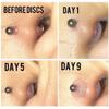 Vdaxvme Piercing Silicone Discs Flexible Anti Hyperplasia Saucer Prevents Irritation Drilling Ear Silicone Flying Saucer view 3