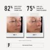 RODAN + FIELDS Instant Targeted Firming Gel Refill | 10 mL / 0.33 Fl Oz view 3