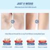 IPL Laser Hair Removal for Women and Men Salon-Level at-Home view 3