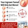 ClearZal Nail Softener, Ingrown Nail Fix Ingrown Toenail Relief & Softening Solution, Extra Strength for Thick Hard Nails,ingrown toenail removal, softener solution, Professional Nail Care Fix, 30ml view 3