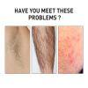 Coconut Oil Facial Hair Removal Cream,Kenshaw Hair Removal Cream,Plant Extract Facial Hair Removal,Facial Hair Removal Cream Coconut Oil,Suitable For Sensitive Skin (1PC) view 3