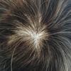 LYRICAL HAIR Toupee for Men Human Hair Replacement System Injected Poly Skin Male Prothesis Durable PU Mens Hairpiece Wig 5"X7" #210 Darkest Brown+10% Gray 120% Medium Light to Medium Density view 4