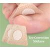 Fresiq Ingrown Toenail Correction Stickers - Pain Relief And Healing Foot Care Patches For Effective Treatment(10pc) view 4