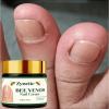 Zynette Bee Venom Nail Hand Cream Cuticle Care Deep Hydration Smooth Shine Moisturizing Healthy Looking Nails 1.76 Oz 1 Pack view 2