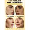 Deep Moisturizer Capsule Cream - Retinol, Peptides & Vitamin C, Long-Lasting Anti-Aging Face Moisturizer For Firmness, Pore, Wrinkle Care & Elasticity Support,For All Skin 2.46 Fl.Oz view 2