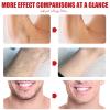 Facial Hair Removal Cream, Painless & Gentle Hair Removal Cream view 4