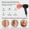 Ice Handle Hair Removal Device, Comfortable and Painless, Home Hair Removal Magic Tool view 3