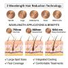Comfortable and Painless Hair Removal Device, Suitable for Lips, Chest, Arms, Legs, Bikini Line Area view 4
