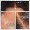NESMON Deep Wave 13x6 SKINLIKE HD Lace Front Wig Human Hair Pre Plucked view 3