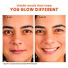 10% Vitamin C-Brightening Face Serum for Glowing Skin, Treats Dark Spots, Pigmentation & Dullness, Beginner & Sensitive Skin Friendly | All Skin Types | Women & Men | 30ml view 3