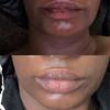 Lip Repair Scrub Exfoliating Lip Treatment for dry, dark chapped Lips view 2