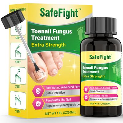 Toenail Fungus Treatment Extra Strength - with 25% Undecylenic Acid - SafeFight Nail Repair Solution for Damaged Nails, Ingrown Nails & Discoloration, 30ML