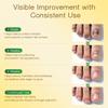 Toenail Fungus Treatment Extra Strength - with 25% Undecylenic Acid - SafeFight Nail Repair Solution for Damaged Nails, Ingrown Nails & Discoloration, 30ML view 3
