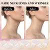 Lnidpd 44pcs Face Neck Lift Tapes Instant Invisible Wrinkle Smoothing Skin Tightening Quick Bands Waterproof High Elastic Pre-Assembled Jaw Jowl Wrinkle Patches for Sagging Women Ladies Beauty view 3