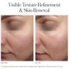 INSTYTUTUM Triple-Action Resurfacing Peel 10% AHA/BHA + Vitamin E, 60 ml view 3