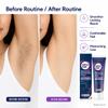 Hair Removal Cream for Men & Women, Depilatory Cream for Sensitive Skin, Moisturizing with Aloe Vera & Vitamin E, for Underarms, Bikini, Arms (1PCS-NYGTMG) view 2