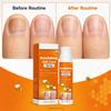 Amavheaf Nourishing Nail Care Spray, 20ml Nail and Cuticle Care Spray, Honey-Inspired Daily Nail Care Mist for Cuticles Fingertips (4PCS) view 2