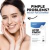 Acne Pimple Patch view 2