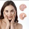 Acne Pimple Patch view 4