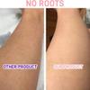 Lady Shaver: Electric Hair Removal for Women Body, Painless Portable Hair Remover with LED Light for Face Leg Hand Bikini Armpit view 3