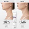 YITOWAY MAGEC Collagen Fullerene Neck Cream with Roller Balls, 2 PCS view 4