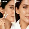 THURLADY Dermaplane Razor for Women Face, 1 Handle + 10 Refills, Rose Gold view 3