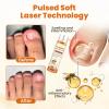Acezozla Fungibee Advanced Nail Repair Spray, 2026 Upgrade Professional Fungibee Nail Spray, Bee Venom Nail Soothing Spray - nail Care Safely and Gently (2cps) view 3