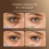 Under Eye Serum for Puffiness & Dark Circles: Caffeine Retinol Peptide Eye Serum for Fine Lines and Wrinkles, Hydrating Daily Eye Care for Women Over 30, 0.7 fl oz view 2