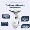 Renewa Skin's RenewaLift Facial Massager view 3